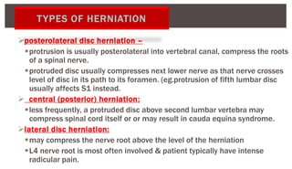 posterolateral disc herniation –
protrusion is usually posterolateral into vertebral canal, compress the roots
of a spinal nerve.
protruded disc usually compresses next lower nerve as that nerve crosses
level of disc in its path to its foramen. (eg.protrusion of fifth lumbar disc
usually affects S1 instead.
 central (posterior) herniation:
less frequently, a protruded disc above second lumbar vertebra may
compress spinal cord itself or or may result in cauda equina syndrome.
lateral disc herniation:
may compress the nerve root above the level of the herniation
L4 nerve root is most often involved & patient typically have intense
radicular pain.
TYPES OF HERNIATION
 