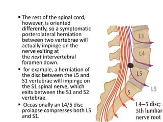 .
 The rest of the spinal cord,
  however, is oriented
  differently, so a symptomatic
  posterolateral herniation
  between two vertebrae will
  actually impinge on the
  nerve exiting at
  the next intervertebral
  foramen down.
 for example, a herniation of
  the disc between the L5 and
  S1 vertebrae will impinge on
  the S1 spinal nerve, which
  exits between the S1 and S2
  vertebrae.
 Occasionally an L4/5 disc
  prolapse compresses both L5
  and S1.
 