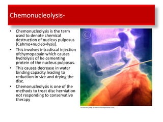 Chemonucleolysis-

• Chemonucleolysis is the term
  used to denote chemical
  destruction of nucleus pulposus
  [Cehmo+nucleo+lysis].
• This involves intradiscal injection
  ofchymopapain which causes
  hydrolysis of he cementing
  protein of the nucleus pulposus.
• This causes decrease in water
  binding capacity leading to
  reduction in size and drying the
  disc.
• Chemonucleolysis is one of the
  methods to treat disc herniation
  not responding to conservative
  therapy
 