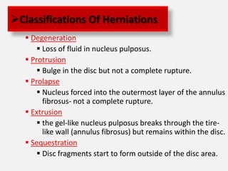 Disc Prolapse Classification Intervertibral disc prolapse | PPTX
