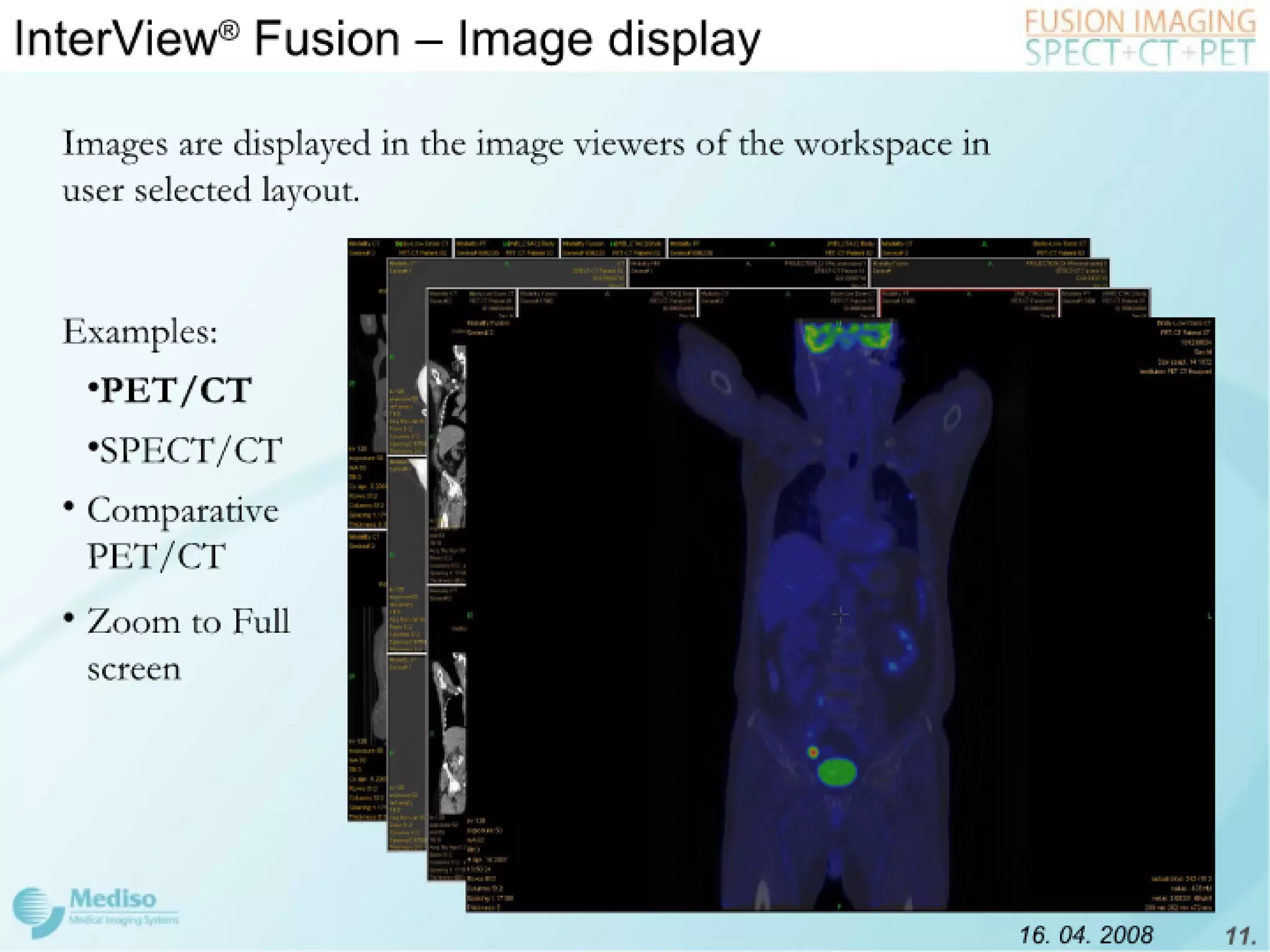 Inter View Featuring Modality Fusion