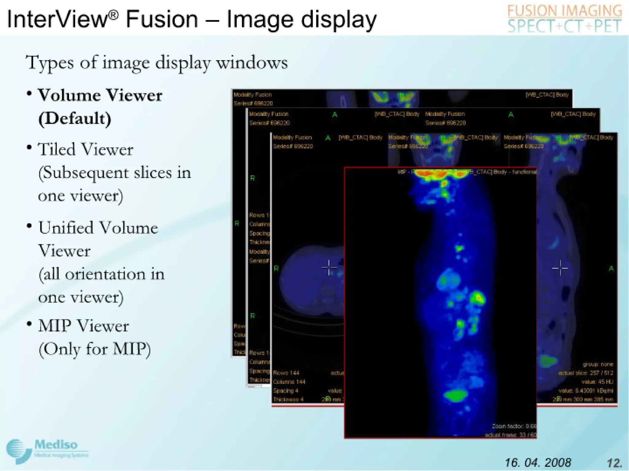 Inter View Featuring Modality Fusion