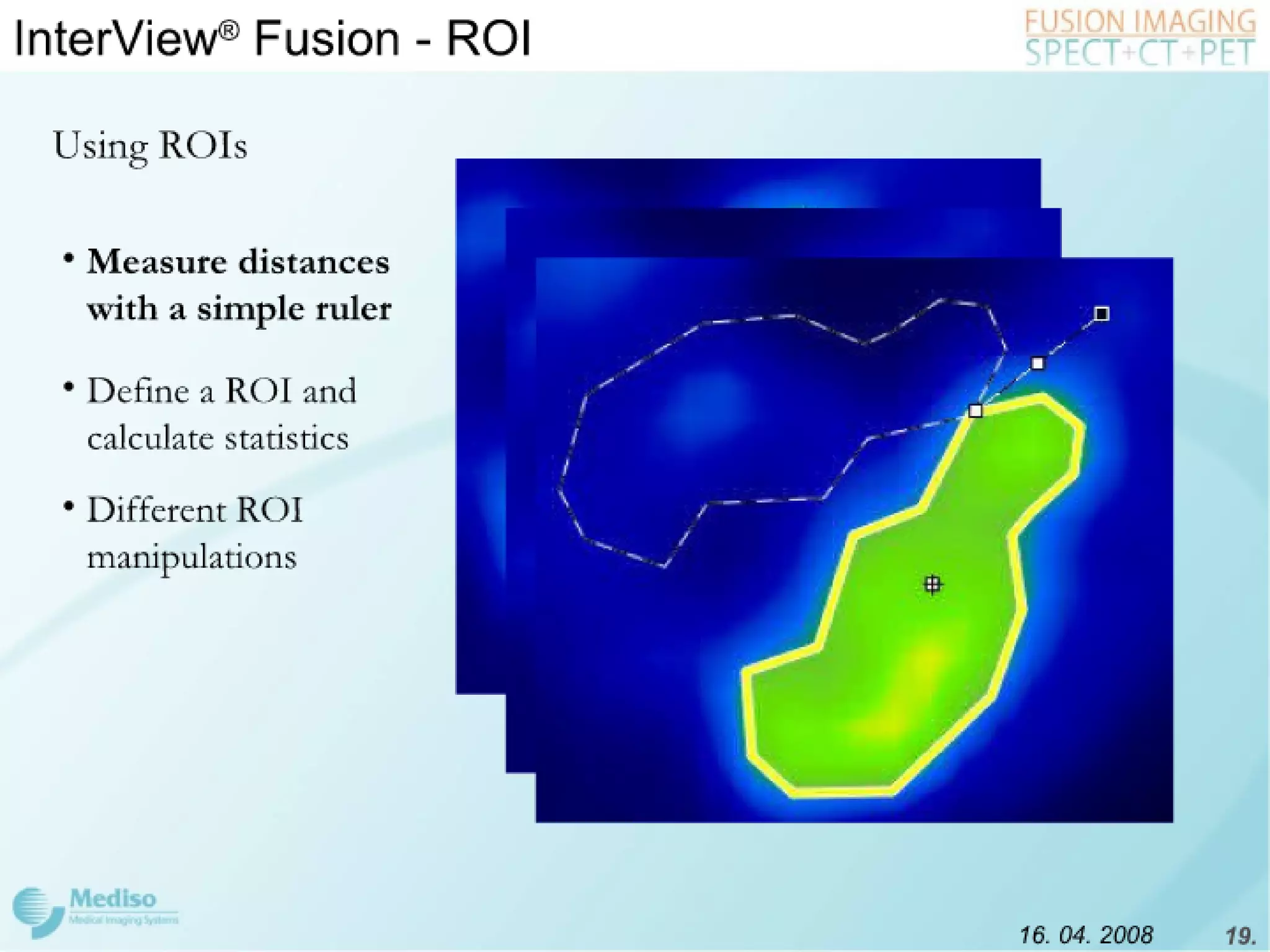 Inter View Featuring Modality Fusion