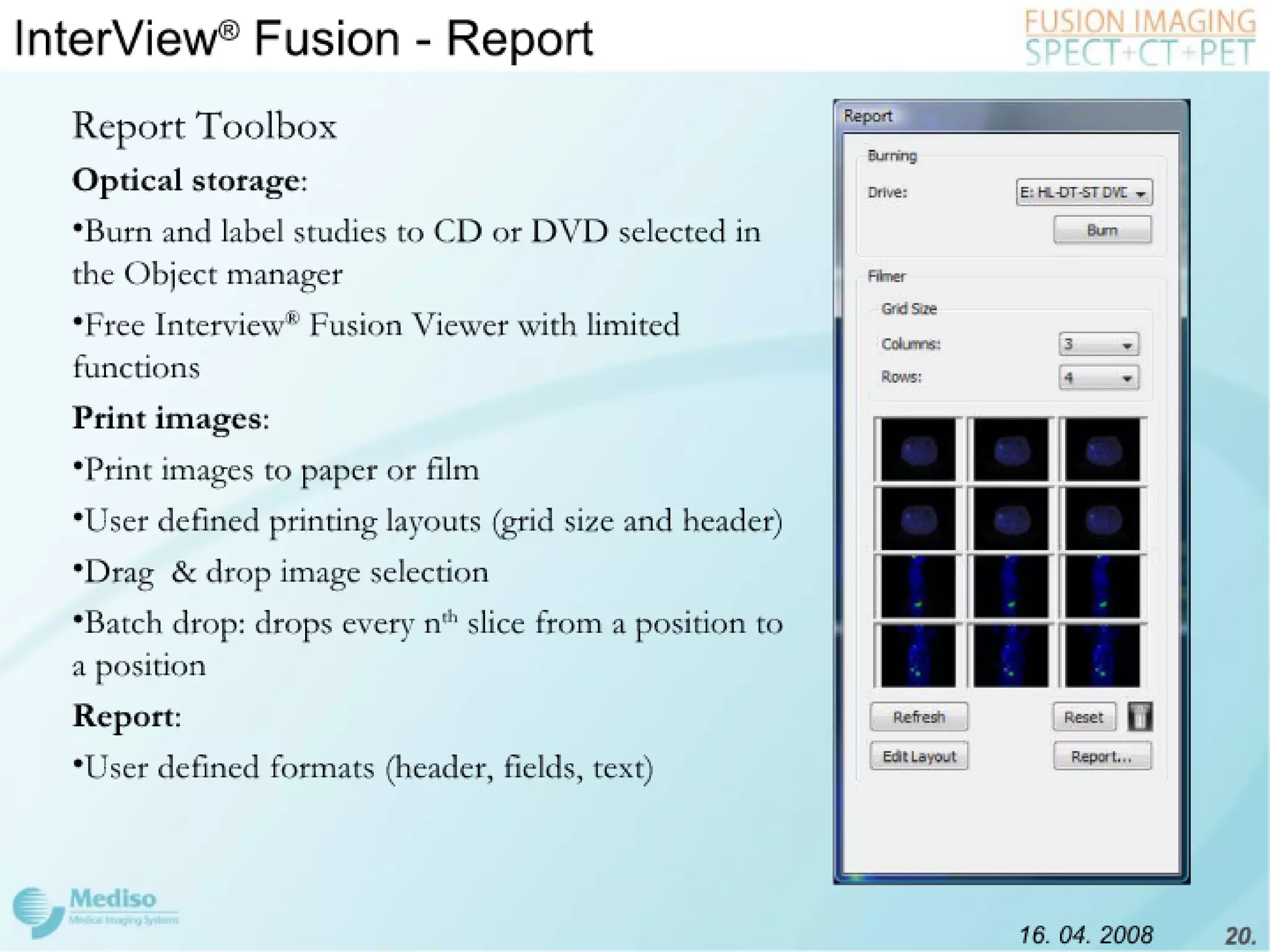 Inter View Featuring Modality Fusion