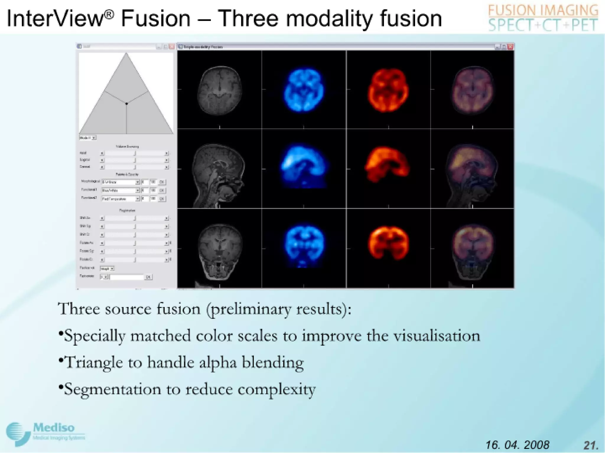 Inter View Featuring Modality Fusion