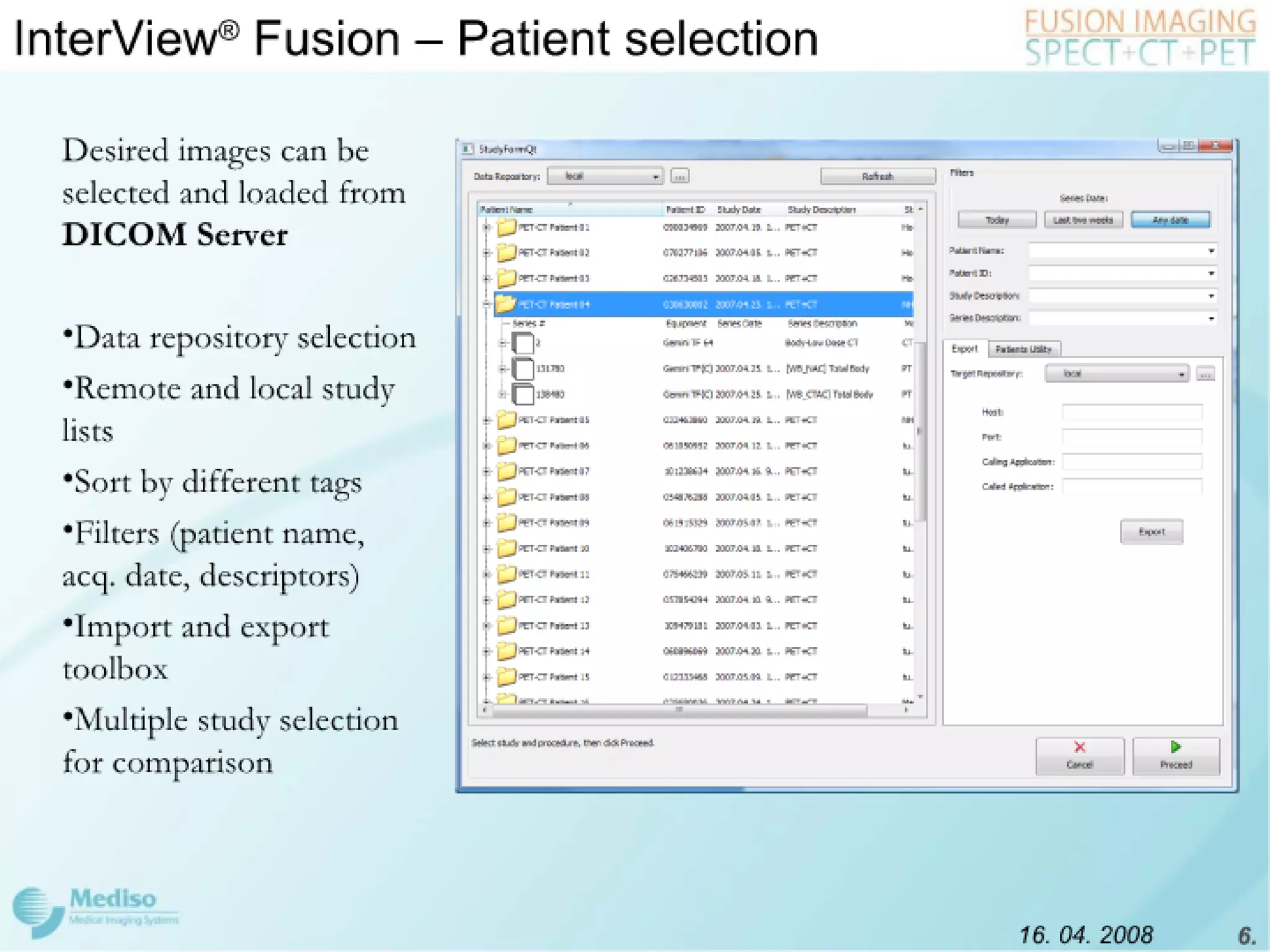 Inter View Featuring Modality Fusion
