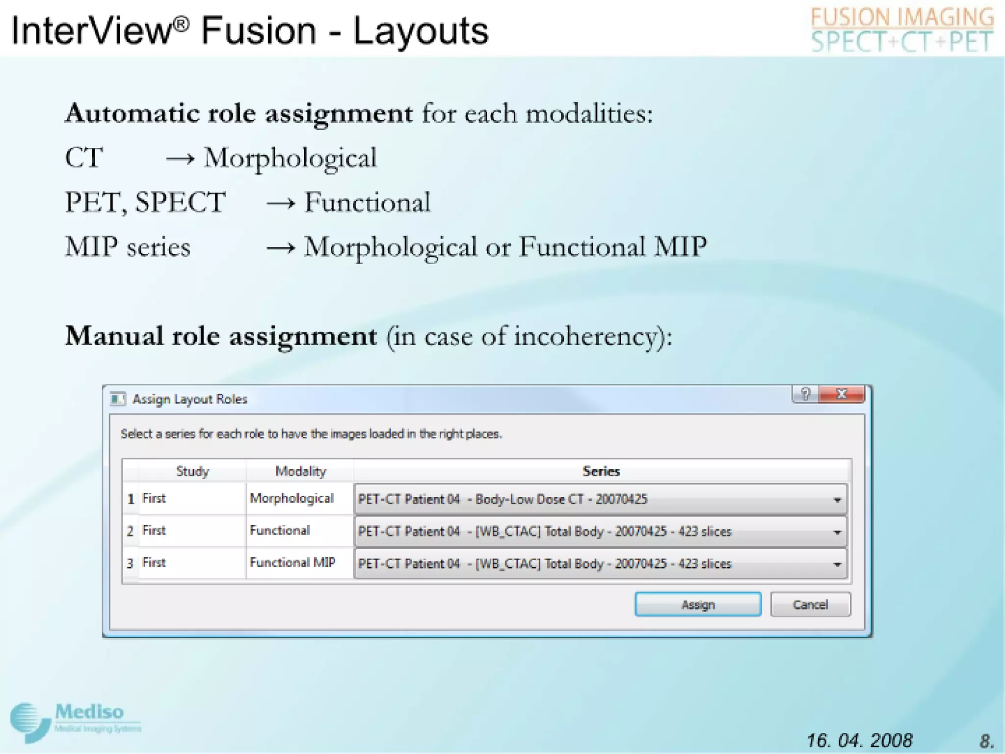Inter View Featuring Modality Fusion