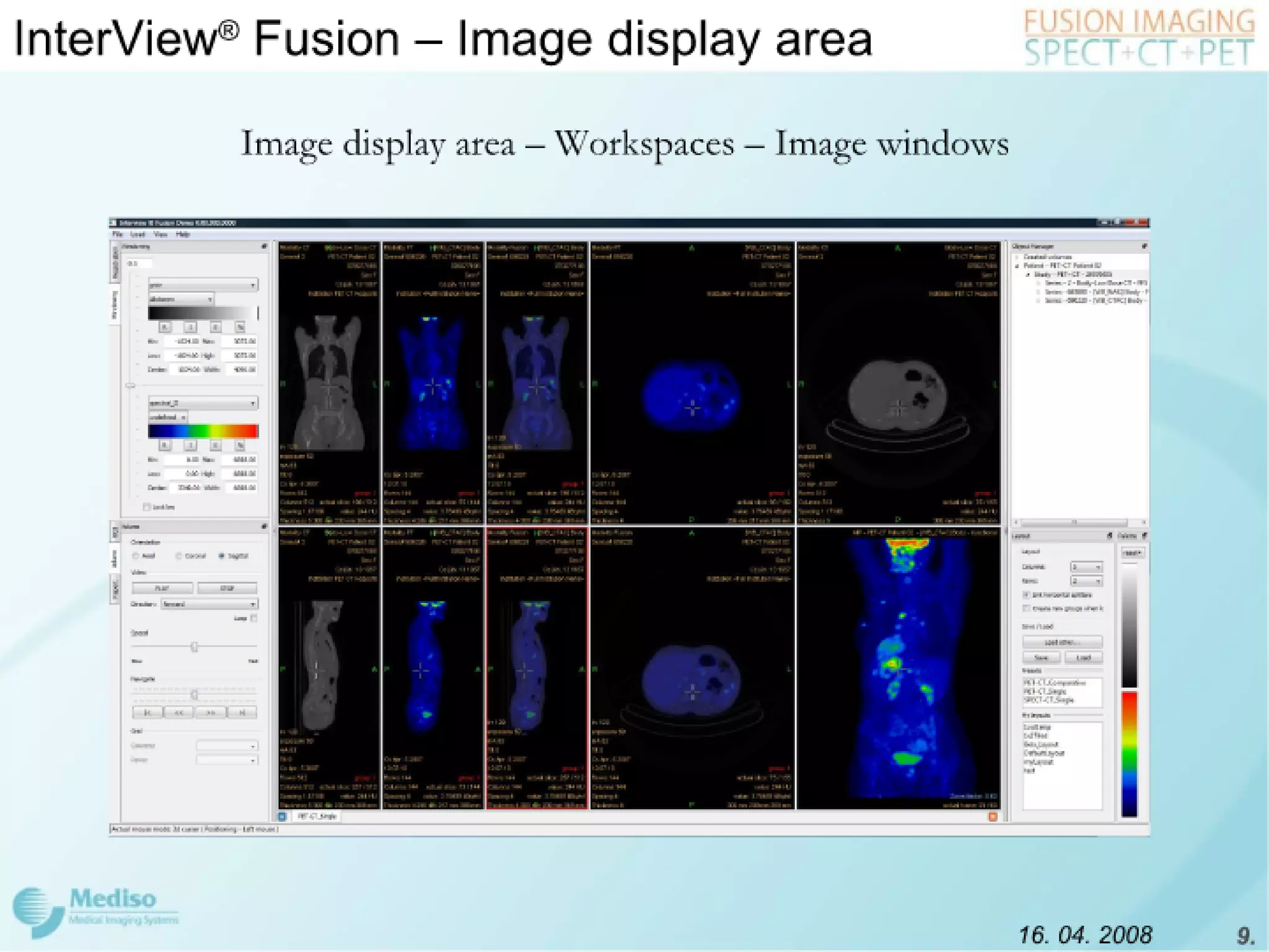 Inter View Featuring Modality Fusion