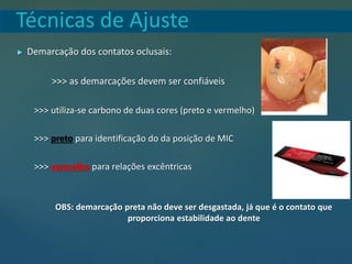 Técnicas de Ajuste
 Demarcação dos contatos oclusais:
>>> as demarcações devem ser confiáveis
>>> utiliza-se carbono de duas cores (preto e vermelho)
>>> preto para identificação do da posição de MIC
>>> vermelho para relações excêntricas
OBS: demarcação preta não deve ser desgastada, já que é o contato que
proporciona estabilidade ao dente
 