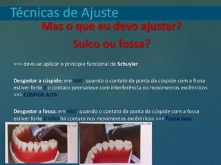 Técnicas de Ajuste
Mas o que eu devo ajustar?
Sulco ou fossa?
>>> deve-se aplicar o princípio funcional de Schuyler
Desgastar a cúspide: em MIC, quando o contato da ponta da cúspide com a fossa
estiver forte E o contato permanece com interferência no movimentos excêntricos
>>> CÚSPIDE ALTA
Desgastar a fossa: em MIC, quando o contato da ponta da cúspide com a fossa
estiver forte E NÃO há contato nos movimentos excêntricos >>> Fossa rasa
 