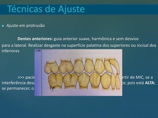 Técnicas de Ajuste
 Ajuste em protrusão
Dentes anteriores: guia anterior suave, harmônica e sem desvios
para a lateral. Realizar desgaste na superfície palatina dos superiores ou incisal dos
inferiores
>>> paciente deve realizar movimento de protrusão a partir de MIC, se a
interferência desaparecer, ajustar a superfície palatina do superior, pois está ALTA;
se permanecer, o dente inferior que deve ser ajustado na incisal
 