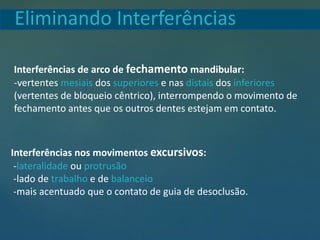 Eliminando Interferências
Interferências de arco de fechamento mandibular:
-vertentes mesiais dos superiores e nas distais dos inferiores
(vertentes de bloqueio cêntrico), interrompendo o movimento de
fechamento antes que os outros dentes estejam em contato.
Interferências nos movimentos excursivos:
-lateralidade ou protrusão
-lado de trabalho e de balanceio
-mais acentuado que o contato de guia de desoclusão.
 