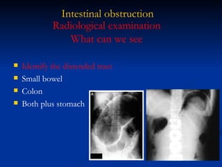 Intestinal obstruction Identify the distended tract Small bowel Colon Both plus stomach Radiological examination What can we see 