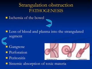 Ischemia of the bowel Strangulation obstruction PATHOGENESIS Loss of blood and plasma into the strangulated segment Gangrene Perforation Peritonitis Sistemic absorption of toxic materia 