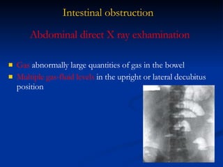 Intestinal obstruction Gas  abnormally large quantities of gas in the bowel  Multiple gas-fluid levels  in the upright or lateral decubitus position Abdominal direct X ray exhamination 