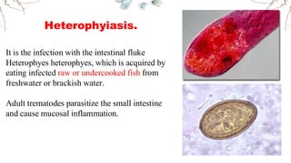 Heterophyidae Comprehensive Overview of Intestinal Trematodes: Fasciolopsis buski ...