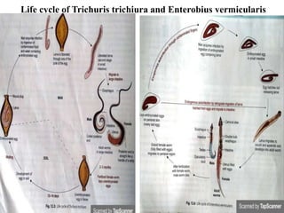 Life cycle of Trichuris trichiura and Enterobius vermicularis
 