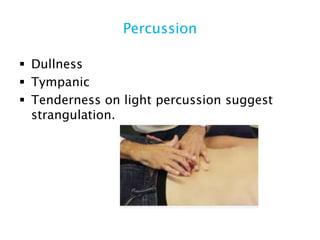 Percussion
 Dullness
 Tympanic
 Tenderness on light percussion suggest
strangulation.
 