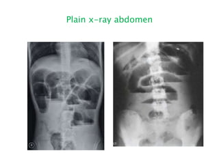 Plain x-ray abdomen
 