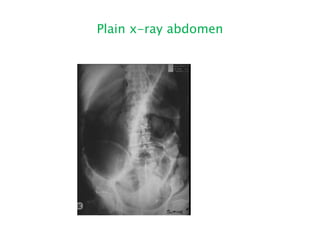 Plain x-ray abdomen
 