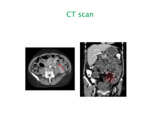 CT scan
 