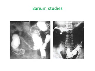 Barium studies
 