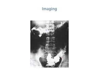 Imaging
 