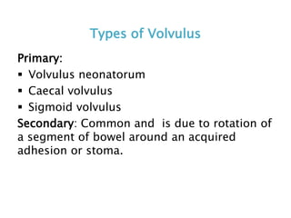 Types of Volvulus
Primary:
 Volvulus neonatorum
 Caecal volvulus
 Sigmoid volvulus
Secondary: Common and is due to rotation of
a segment of bowel around an acquired
adhesion or stoma.
 