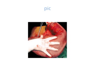 pic
 