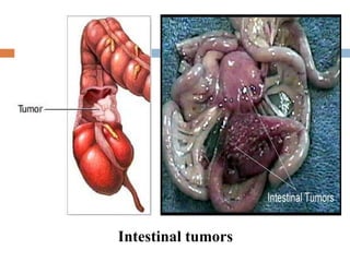 Intestinal tumors 
