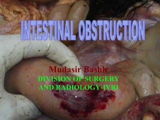 INTESTINAL OBSTRUCTION Mudasir Bashir DIVISION OF SURGERY AND RADIOLOGY-IVRI 