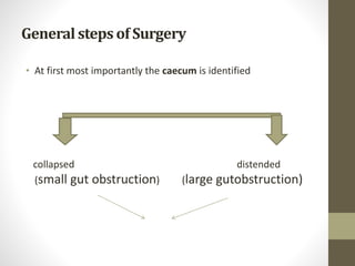 Generalsteps of Surgery
• At first most importantly the caecum is identified
collapsed distended
(small gut obstruction) (large gutobstruction)
 