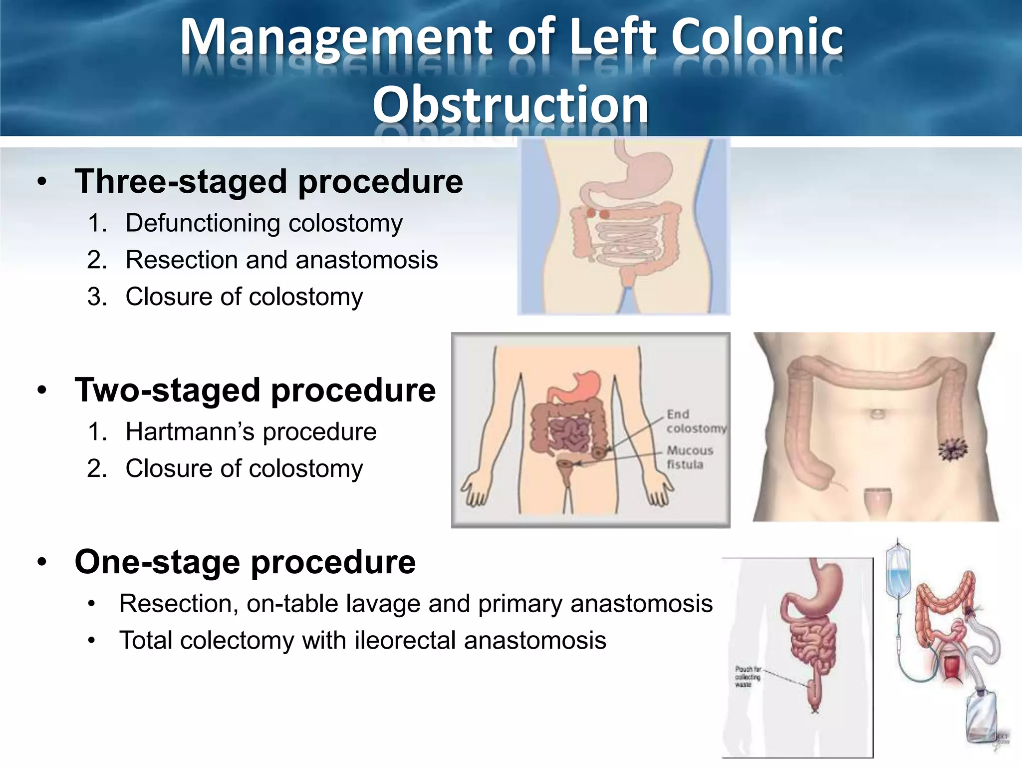 Intestinal obstruction | PPTX