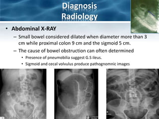 Diagnosis
Radiology
• Abdominal X-RAY
– Small bowel considered dilated when diameter more than 3
cm while proximal colon 9 cm and the sigmoid 5 cm.
– The cause of bowel obstruction can often determined
• Presence of pneumobilia suggest G.S ileus.
• Sigmoid and cecal volvulus produce pathognomnic images
 