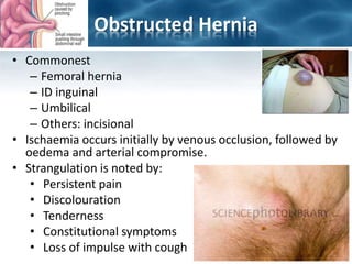 Obstructed Hernia
• Commonest
– Femoral hernia
– ID inguinal
– Umbilical
– Others: incisional
• Ischaemia occurs initially by venous occlusion, followed by
oedema and arterial compromise.
• Strangulation is noted by:
• Persistent pain
• Discolouration
• Tenderness
• Constitutional symptoms
• Loss of impulse with cough
 