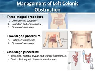 Management of Left Colonic
Obstruction
• Three-staged procedure
1. Defunctioning colostomy
2. Resection and anastomosis
3. Closure of colostomy
• Two-staged procedure
1. Hartmann’s procedure
2. Closure of colostomy
• One-stage procedure
• Resection, on-table lavage and primary anastomosis
• Total colectomy with ileorectal anastomosis
 