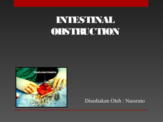 INTESTINAL
OBSTRUCTION
Disediakan Oleh : Nassruto
 