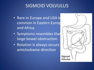 SIGMOID VOLVULUS
• Rare in Europe and USA but
common in Eastern Europe
and Africa.
• Symptoms resembles that of
large bowel obstruction.
• Rotation is always occurs in
anticlockwise direction.
 