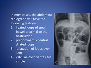 In most cases, the abdominal
radiograph will have the
following features:
1. ileated loops of small
bowel proximal to the
obstruction
2. predominantly central
dilated loops
3. dilatation of loops over
3cm
4. valvulae conniventes are
visible
 