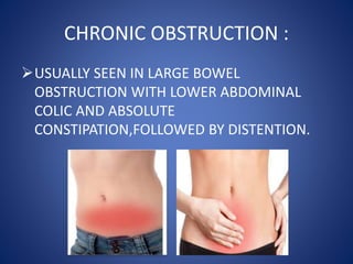 CHRONIC OBSTRUCTION :
USUALLY SEEN IN LARGE BOWEL
OBSTRUCTION WITH LOWER ABDOMINAL
COLIC AND ABSOLUTE
CONSTIPATION,FOLLOWED BY DISTENTION.
 