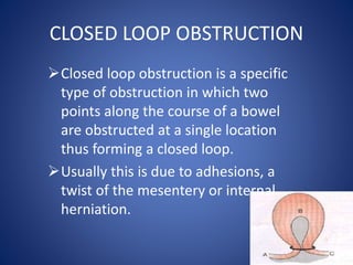 CLOSED LOOP OBSTRUCTION
Closed loop obstruction is a specific
type of obstruction in which two
points along the course of a bowel
are obstructed at a single location
thus forming a closed loop.
Usually this is due to adhesions, a
twist of the mesentery or internal
herniation.
 