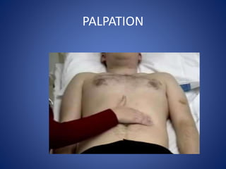 PALPATION
 