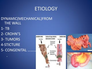 ETIOLOGY
DYNAMIC(MECHANICAL)FROM
THE WALL
1- TB
2- CROHN’S
3- TUMORS
4-STICTURE
5- CONGENITAL ……… .
.
 