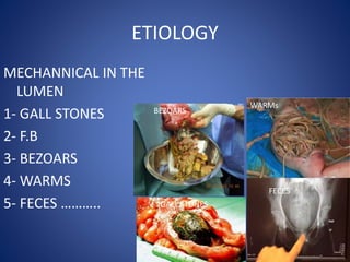ETIOLOGY
MECHANNICAL IN THE
LUMEN
1- GALL STONES
2- F.B
3- BEZOARS
4- WARMS
5- FECES ……….. GALL STONES
BEZOARS
WARMs
FECES
 