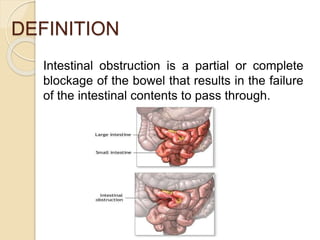 DEFINITION
Intestinal obstruction is a partial or complete
blockage of the bowel that results in the failure
of the intestinal contents to pass through.
 