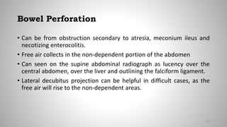 Bowel Perforation
• Can be from obstruction secondary to atresia, meconium ileus and
necotizing enterocolitis.
• Free air collects in the non-dependent portion of the abdomen
• Can seen on the supine abdominal radiograph as lucency over the
central abdomen, over the liver and outlining the falciform ligament.
• Lateral decubitus projection can be helpful in difficult cases, as the
free air will rise to the non-dependent areas.
115
 