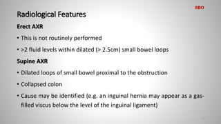 Radiological Features
Erect AXR
• This is not routinely performed
• >2 fluid levels within dilated (> 2.5cm) small bowel loops
Supine AXR
• Dilated loops of small bowel proximal to the obstruction
• Collapsed colon
• Cause may be identified (e.g. an inguinal hernia may appear as a gas-
filled viscus below the level of the inguinal ligament)
15
SBO
 