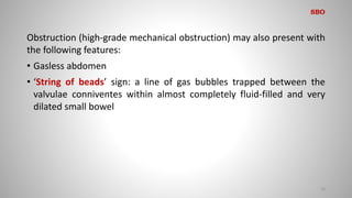 Obstruction (high-grade mechanical obstruction) may also present with
the following features:
• Gasless abdomen
• ‘String of beads’ sign: a line of gas bubbles trapped between the
valvulae conniventes within almost completely fluid-filled and very
dilated small bowel
16
SBO
 