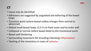 CT
• Cause may be identified
• Adhesions are suggested by angulated and tethering of the bowel
loops
• Transition point (where bowel calibre changes from normal to
abnormal)
• Dilated small bowel loops >2.5-3 cm from outer wall to outer wall
• Collapsed or normal calibre bowel distal to the transitional point
• Bowel wall thickening
• Surrounding mesenteric fat stranding indicating inflammation
• Twisting of the mesentery in cases of volvulus
20
SBO
 