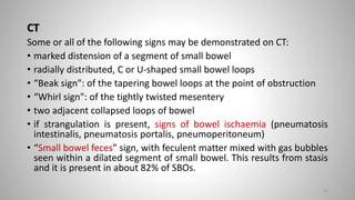 CT
Some or all of the following signs may be demonstrated on CT:
• marked distension of a segment of small bowel
• radially distributed, C or U-shaped small bowel loops
• “Beak sign": of the tapering bowel loops at the point of obstruction
• “Whirl sign": of the tightly twisted mesentery
• two adjacent collapsed loops of bowel
• if strangulation is present, signs of bowel ischaemia (pneumatosis
intestinalis, pneumatosis portalis, pneumoperitoneum)
• “Small bowel feces" sign, with feculent matter mixed with gas bubbles
seen within a dilated segment of small bowel. This results from stasis
and it is present in about 82% of SBOs.
25
 